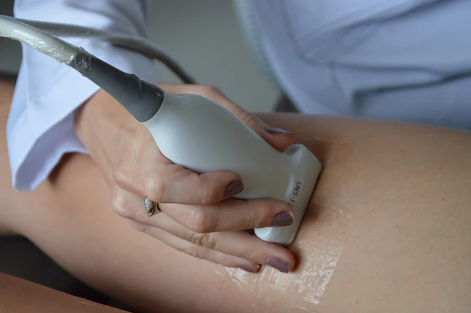 Detalhe de avaliação vascular no consultório